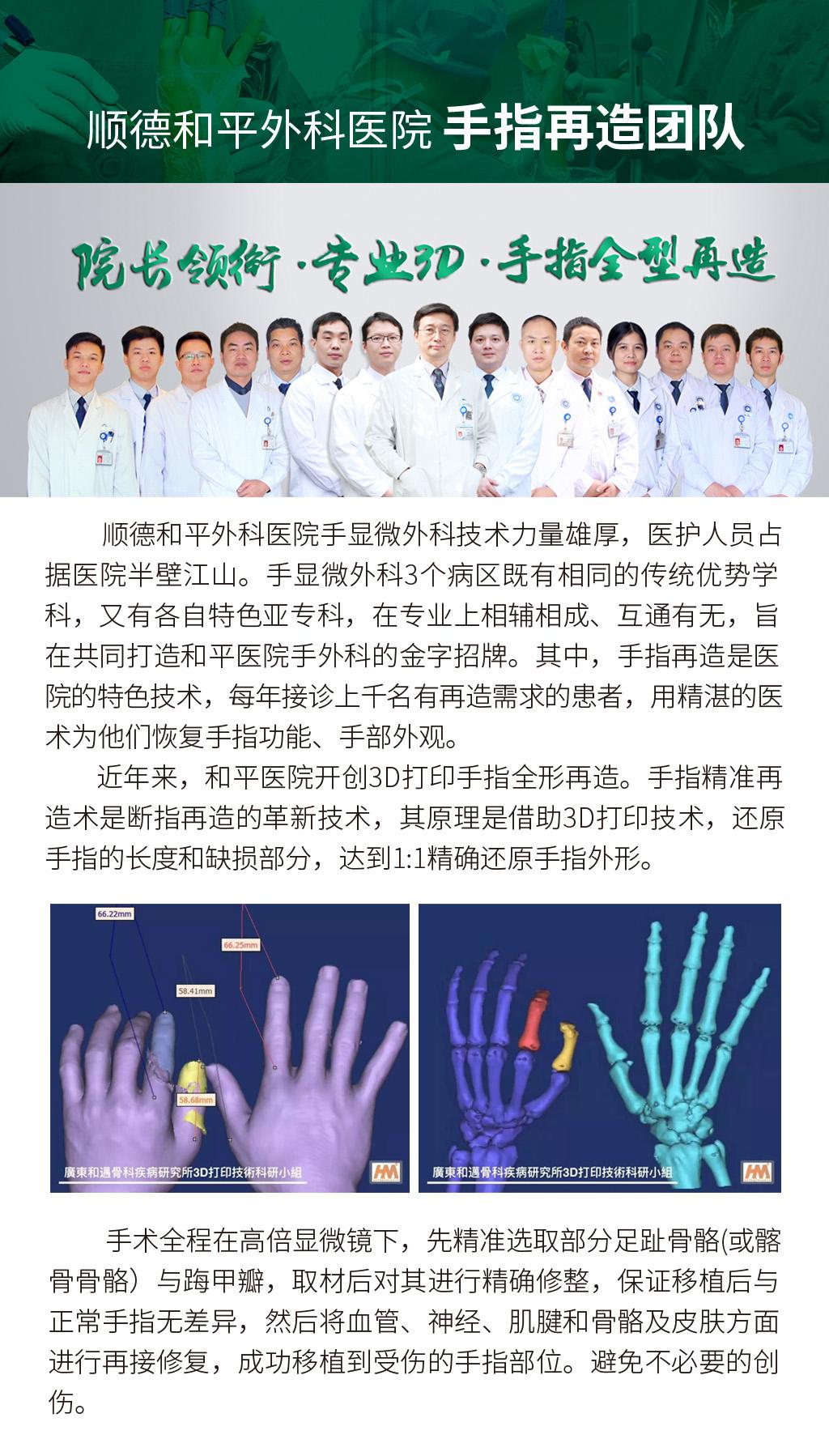 江西美女顺德求医，３Ｄ全型手指再造术助其重拾完整左手与自信